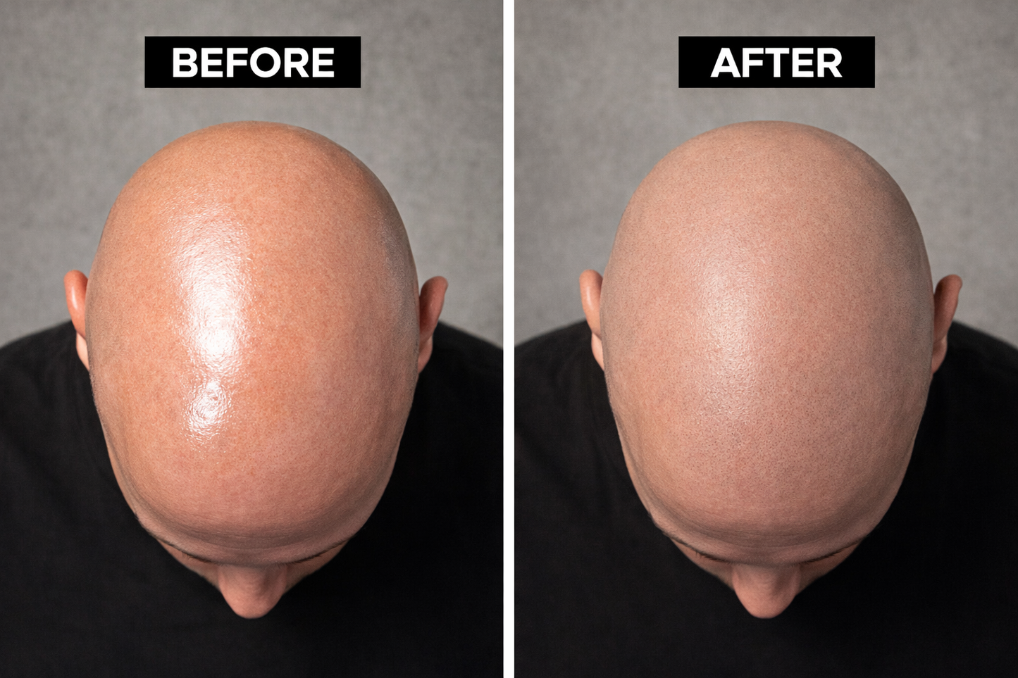 HEAD MATTE - Shine Block