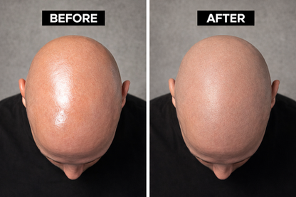 HEAD MATTE - Shine Block