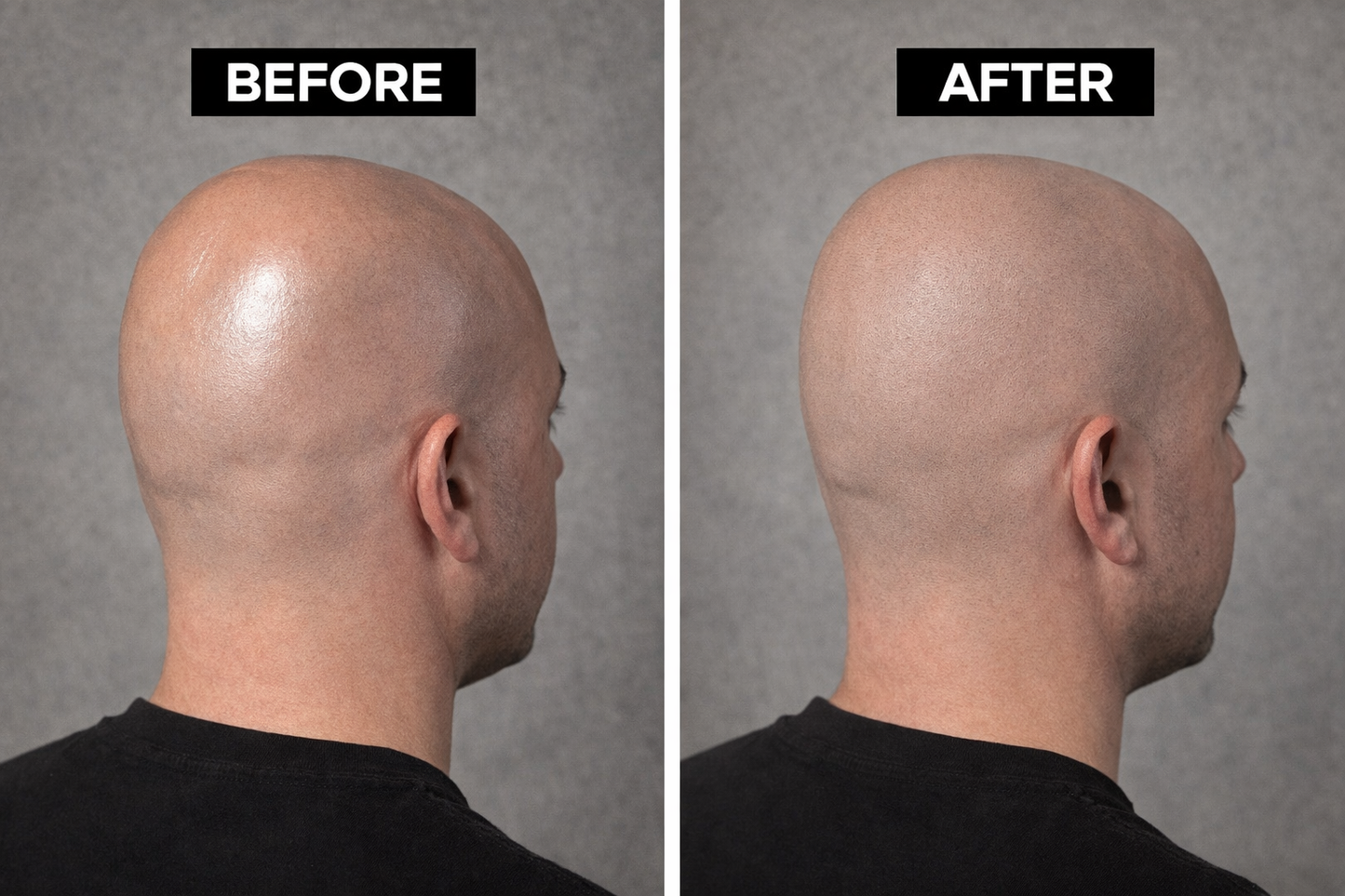 HEAD MATTE - Shine Block